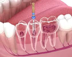 Elysium Dental Clinic - Clinica dentara