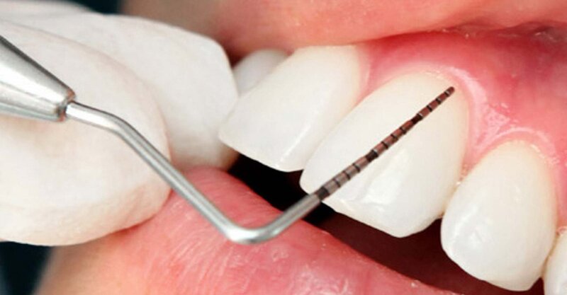 Elysium Dental Clinic - Clinica dentara