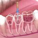 Elysium Dental Clinic - Clinica dentara